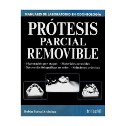 Prótesis Parcial Removible